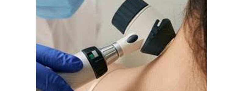 Skin Related Problems in Nerul